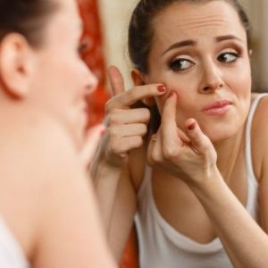 Lo que tenés que saber si padecés de acné